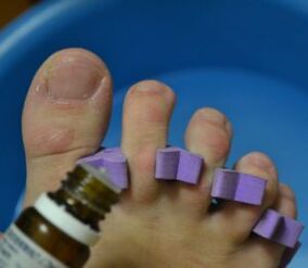 Preparato per il trattamento delle unghie con gocce antifungine