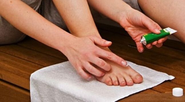 Trattare il fungo dell'unghia del piede con un unguento